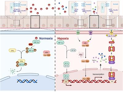The mechanism of colon tissue damage mediated by HIF-1α/NF-κB/STAT1 in high-altitude environment